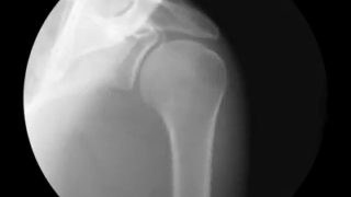 مفصل زانو در زیر اشعه ×