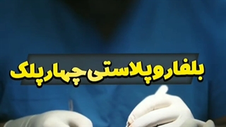 بلفاروپلاستی 4 پلک در کلینیک vip تهران