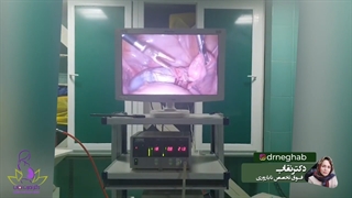 جراحی لاپاروسکوپی