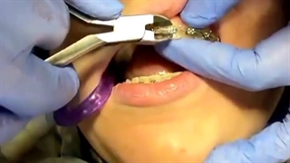 درمان ارتودنسی توسط دکتر نگار حدادی جوانسازی پوست