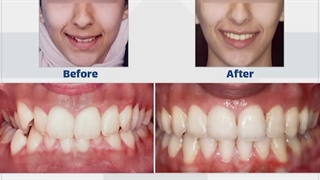 نمونه کار ارتودنسی