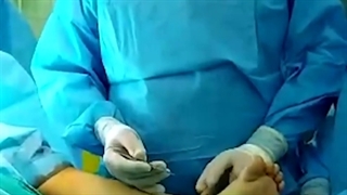 عفونت حاد استخوان