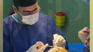 بلافاصله بعد از لیفت شقیقه کلینیک vip