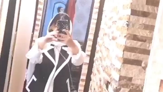 کاهش وزن فوق العاده با عمل بای پس کلاسیک معده توسط دکتر شاهین جمیلی