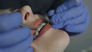 فریب بدن توسط ارتودنسی