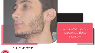 عمل دماغ استخوانی