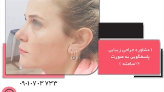 هزینه عمل بینی