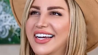 لمینت سرامیکی ایمکس