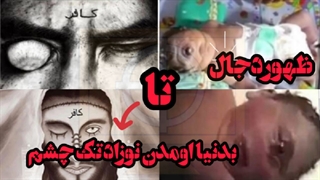 ظهوردجال|به دنیا اومدن نوزاد تک چشم