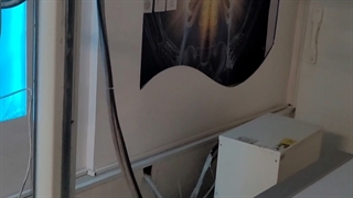 معرفی دستگاه رادیولوژی (رادیوگرافی) جنرال بخش اول