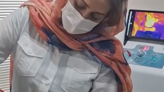 لیفتینگ و جوانسازی پوست با دستگاه پزشکی Endo-RF Subcision ترمیم لبخند لثه‌ای