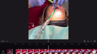 آموزش تولید محتوا ساخت ریلز دندانپزشکی