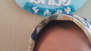 بوتاکس پیشانی