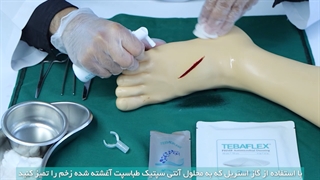 نحوه استفاده از طباگرن و طباگرن پلاس نقره - پانسمان گرانول کلاژن نقره