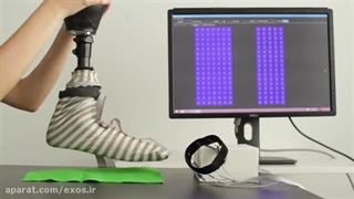 اندام مصنوعی