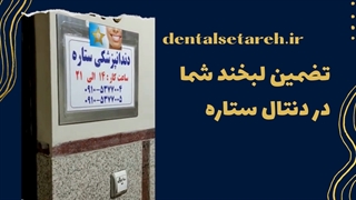 بهترین مرکز ایمپلنت در غرب تهران