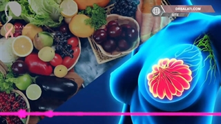 پیشگیری از سرطان سینه