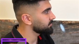 نمونه جراحی بینی فوق العاده مردانه