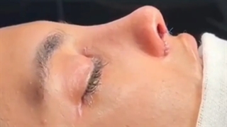 لحظات عمل بینی یک خانم