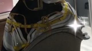 لابیاپلاستی دردناکه یا نه؟