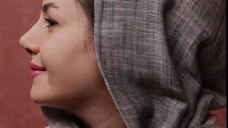 میزان رضایتمندی مراجعه کننده عزیزمون از جراحی بینی توسط آقای دکتر سعید ظفرمند