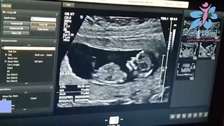 چگونگی بررسی ناهنجاری در جنین در سونوگرافی غربالگری