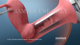 آزمایش یا تست پاپ اسمیر چیست؛ جواب، هزینه و زمان انجام