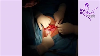 تولد دیان عزیزم 1