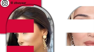 هزینه عمل بینی مردانه در تهران