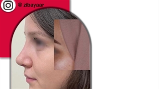 جراح پلاستیک