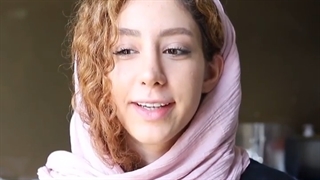 رضایت مشتری عزیز از کار کامپوزیت بعد از 7 سال