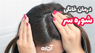 درمان شوره سر در خانه | آچاره