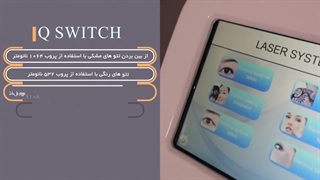 معرفی و ویژگی های دستگاه لیزر موهای زائد کیوسوئیچ