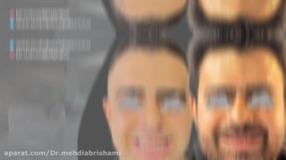 جراح فک در اصفهان | دکتر مهدی ابریشمی