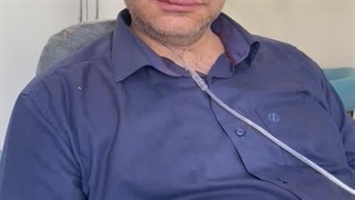 نتیجه ایمپلنت با بیهوشی