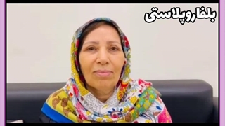 بلفاروپلاستی عمل افتادگی پلک