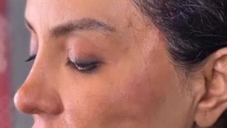 لیفت و بازسازی پوست صورت برداشتن زگیل