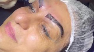 بهترین پزشک کاشت ابرو در تهران |پارمیدا