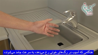 تفاوت بین لخته خون و ترومبوز