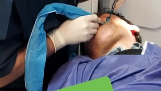 دکتر مهدی کریمی لیپوساکشن