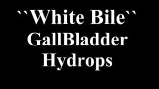 صفرای سفید در هیدروپس کیسه صفرا